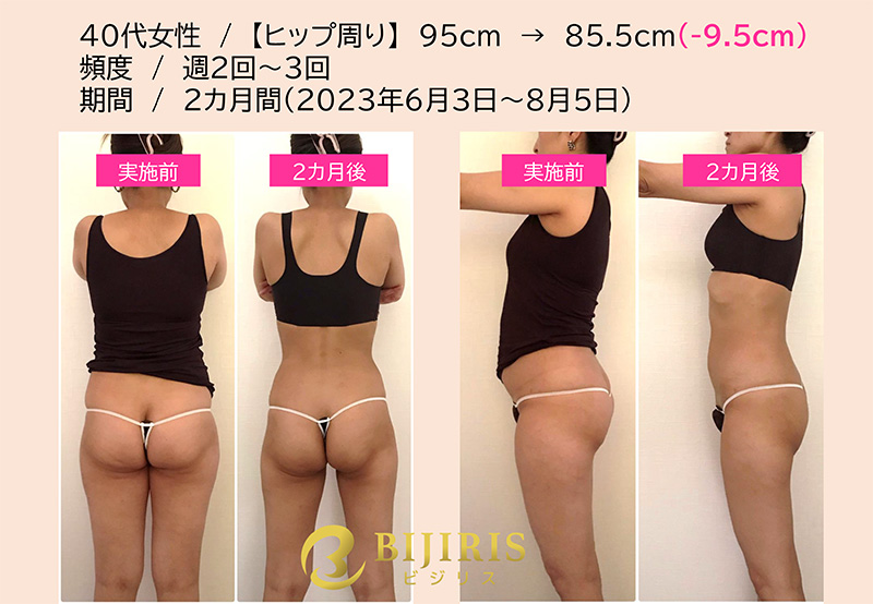 【画像】ビジリス ビフォーアフター写真