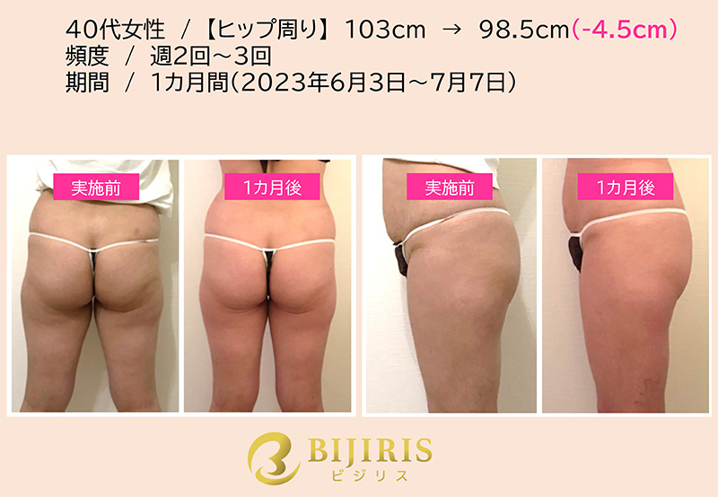 【画像】ビジリス ビフォーアフター写真
