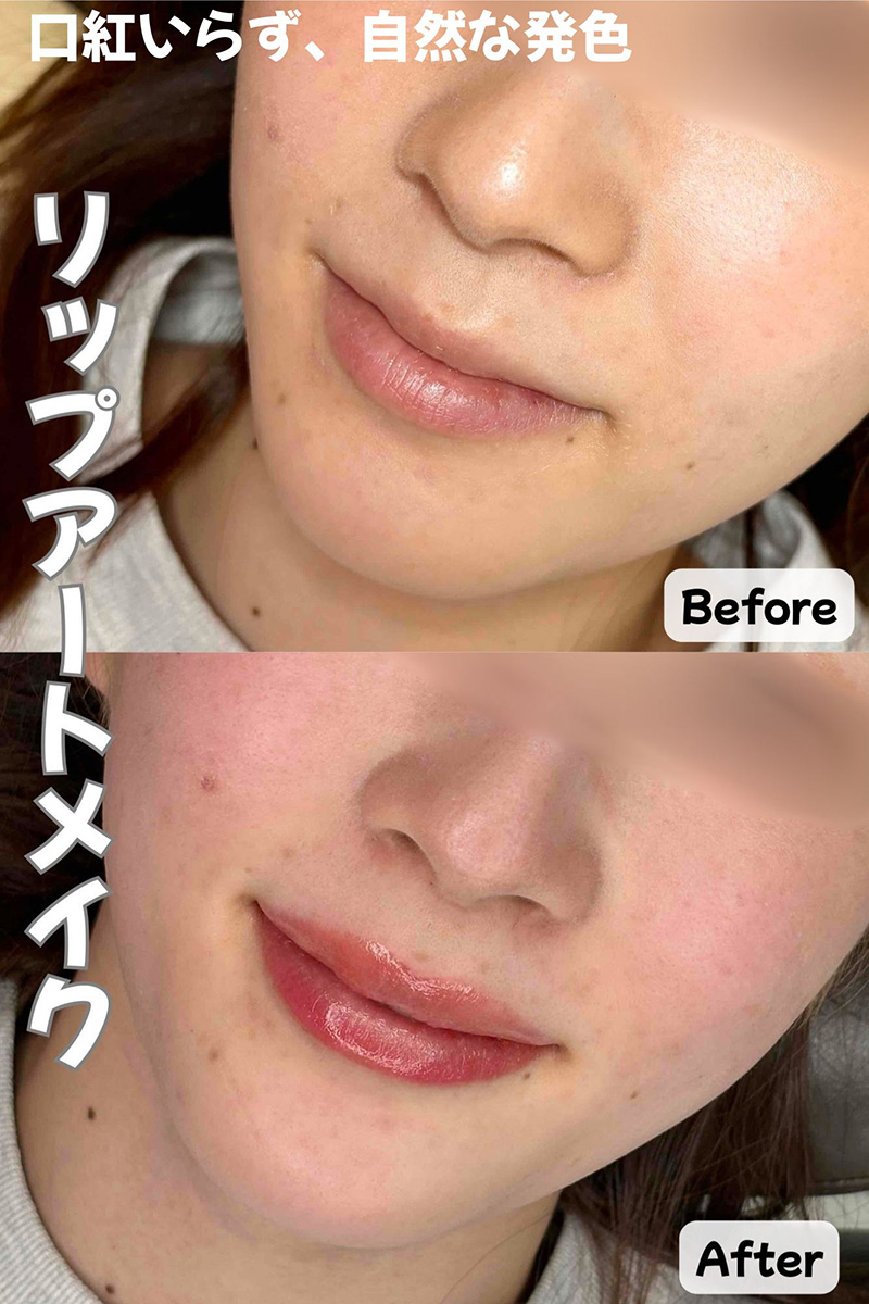 医療ハイフ・アートメイク | 神奈川区・港北区・循環器内科・消化器