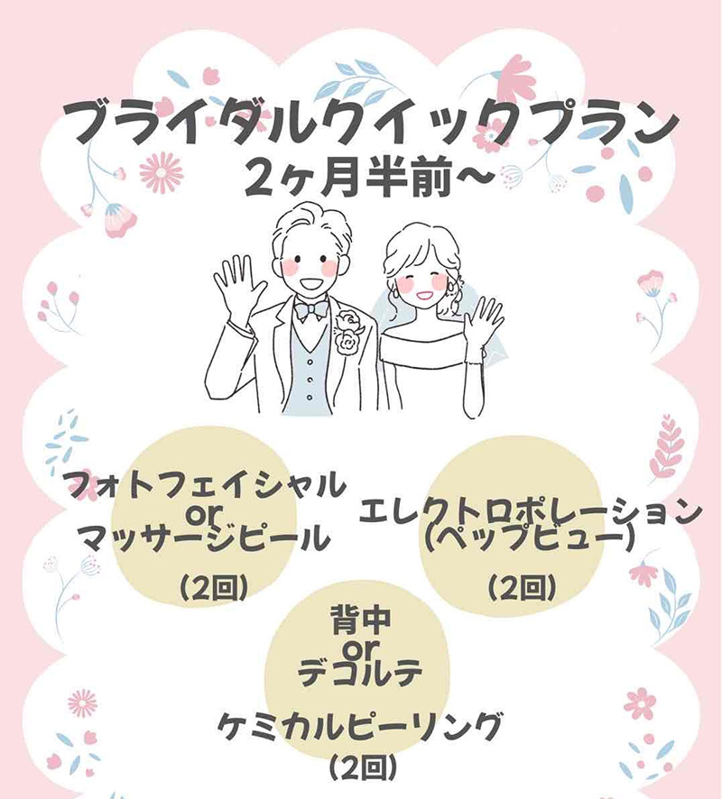 【画像】ブライダルクイックプラン
